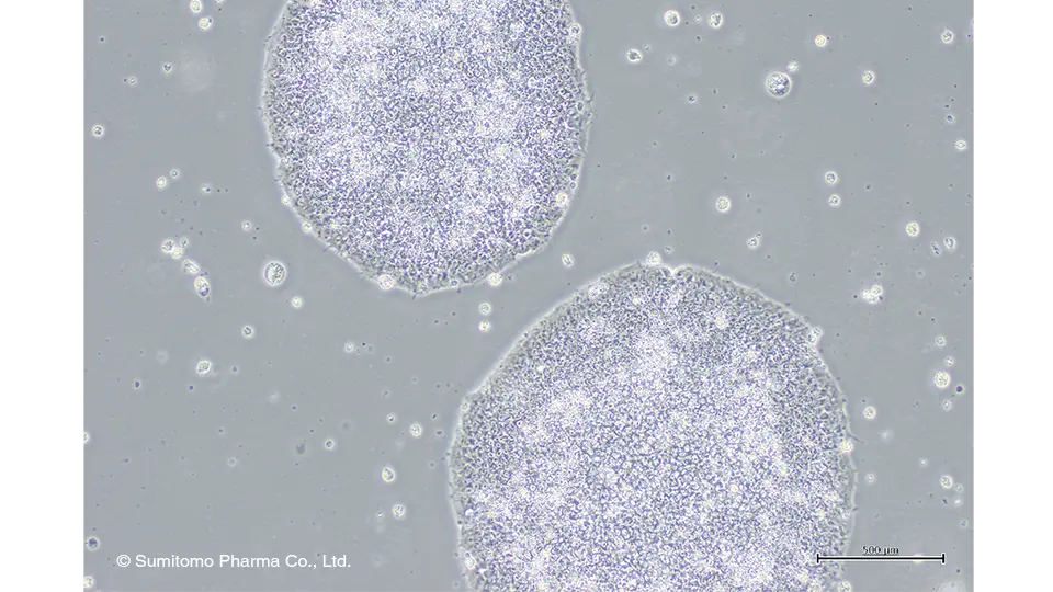 神戸センター培養