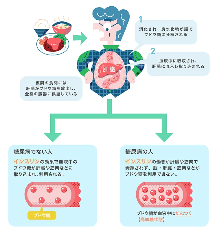 糖尿病とは