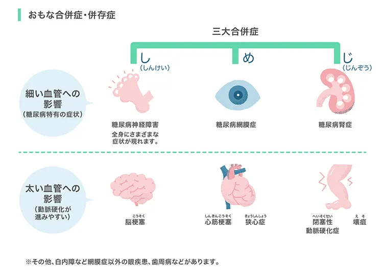 主な合併症・併存症 三大合併症(糖尿病神経障害・糖尿病網膜症・糖尿病腎臓症)、脳梗塞、心筋梗塞、狭心症、下肢閉塞性動脈硬化症、壊疽