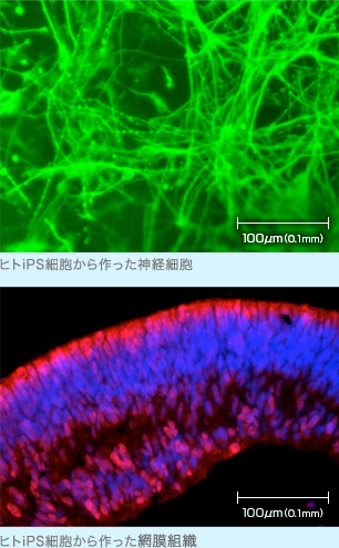 ヒトiPS細胞から作った神経細胞（上）と網膜組織（下）