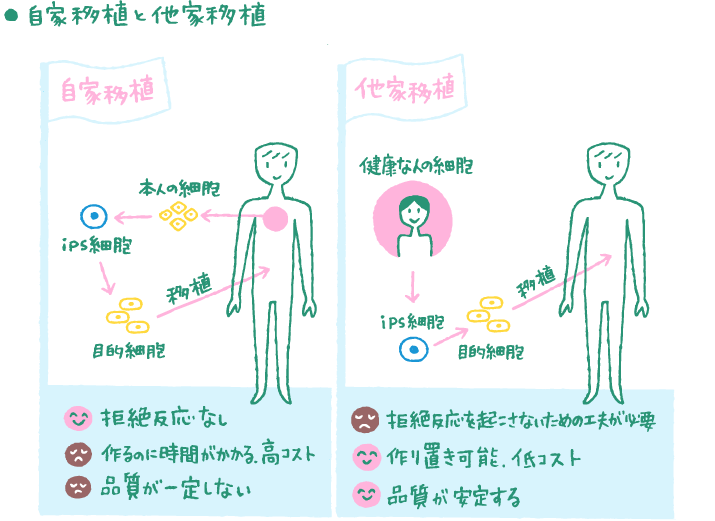 自家移植と他家移植