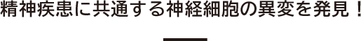 精神疾患に共通する神経細胞の異変を発見！